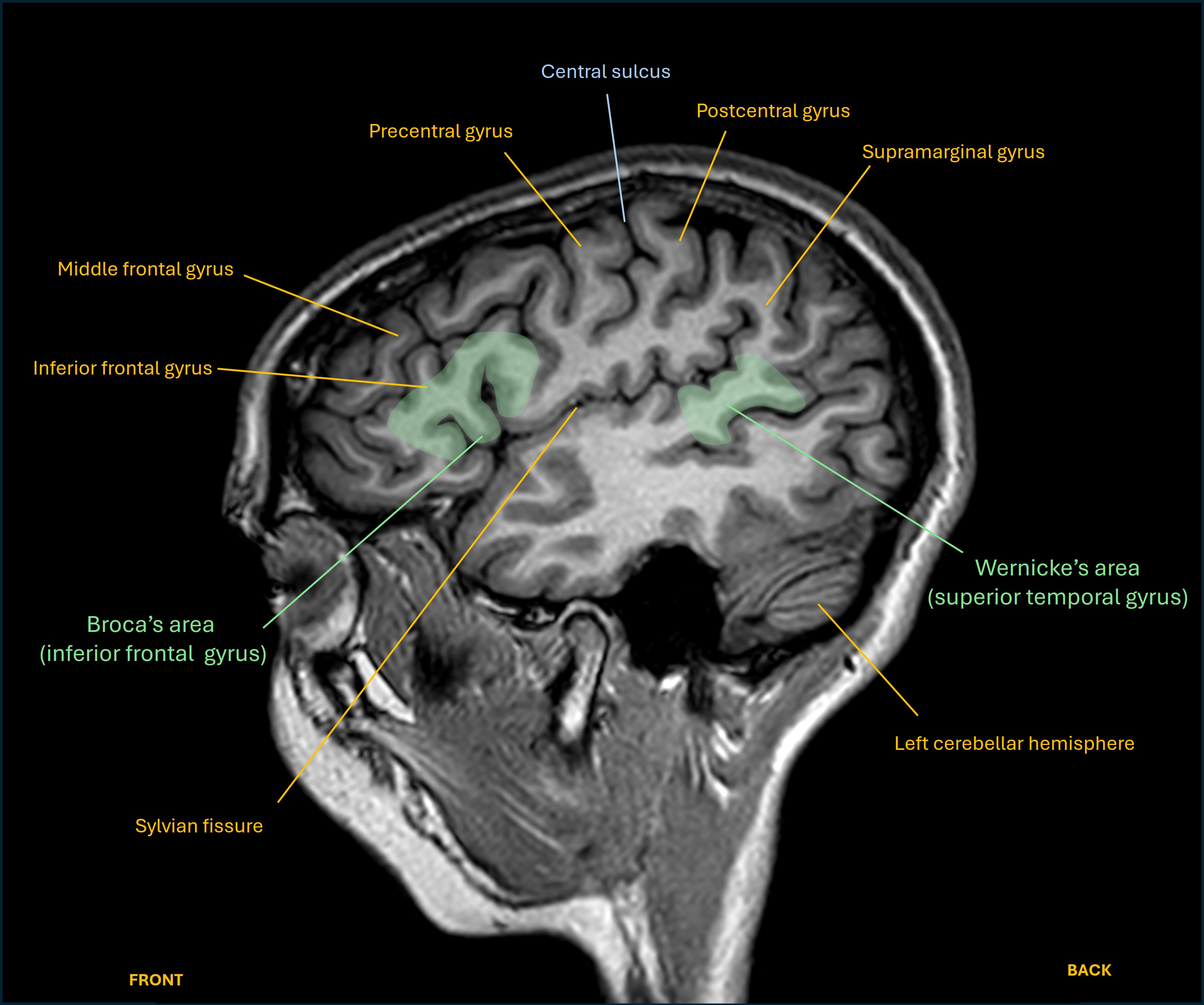 Sagittal language